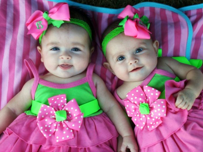 monozigóticos gêmeos-grande-bebê-menina-de-rosa vestido